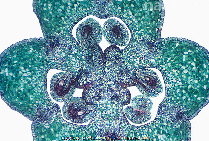 Ovary section transverse sketch transver