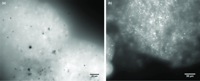 Are nuclei visible in cyanobacterial cells