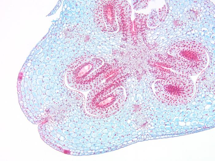 Cross section of lily ovary