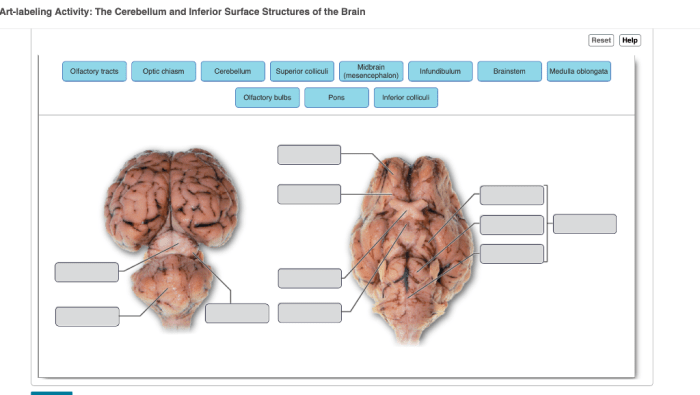 Art-labeling activity internal midsagittal view of the skull